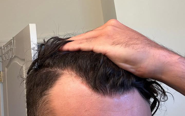 After — Week 4