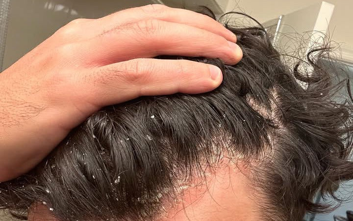 Before — Day 1